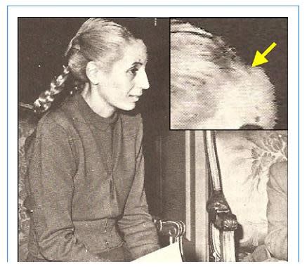 Was Evita Lobotomized? | Discover Magazine