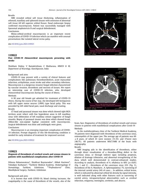 (PDF) Post COVID-19 rhinocerebral mucormycosis presenting with stroke