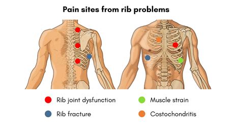 Chest Or Rib Pain? Causes and Solutions - Sundial Clinics