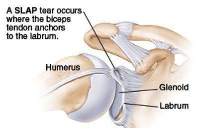 Shoulder Anatomy Labrum