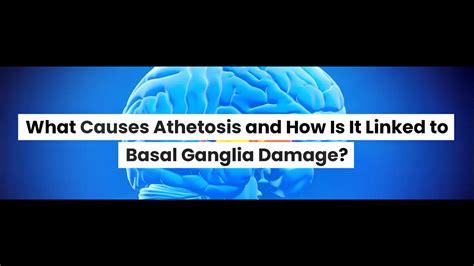 What is Athetosis? What Causes Athetosis? - YouTube