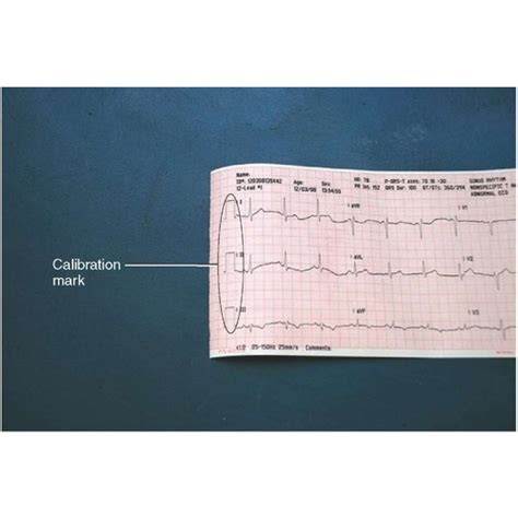 ECG Machine Instrument Calibration Service at Rs 100 in New Delhi | ID: 20184238312