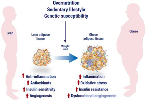 Obesity and Surviving the COVID19 Pandemic: Weight loss Boosts Immunity | Advanced Laparoscopic ...