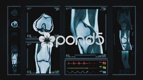 3d mri near me