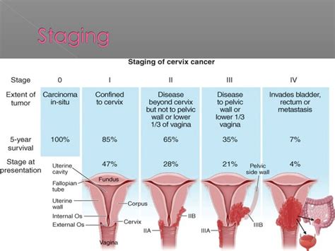 Cancer of cervix