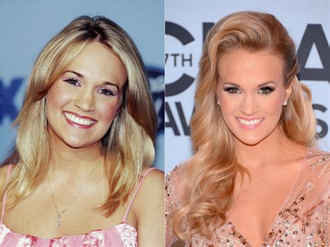 Celebrity Carrie Underwood - plastic surgery, photos, video