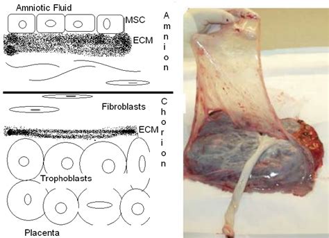 Amniotic Sac Anatomy