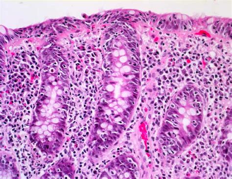 Webpathology.com: A Collection of Surgical Pathology Images