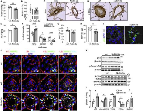 Nutlin 3a treatment decreases pulmonary artery remodeling and PH in... | Download Scientific Diagram