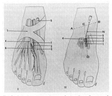 Figure 3 from Ankle-Foot Peripheral Nerve Block for Mid and Forefoot Surgery | Semantic Scholar