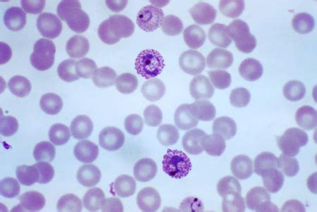 Plasmodium Microscope Slide