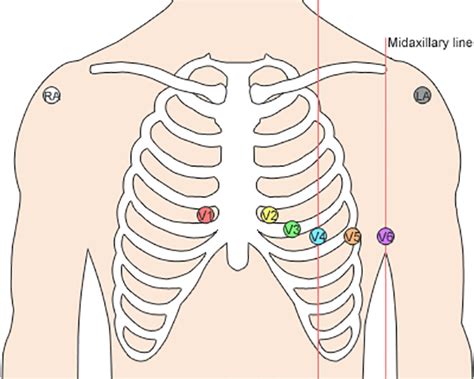 Pediatric ECG Lead Placement – Pediatric Cardiology Center of Oregon