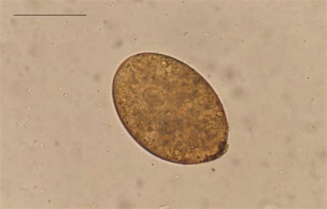 Intestinal Flukes - Troccap