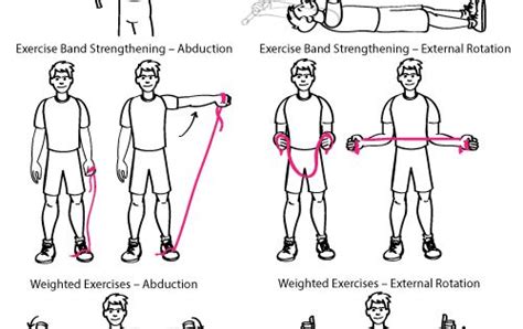 Supraspinatus Tendon Tear Exercises