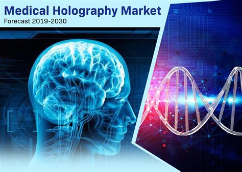 Medical holography Market - Forecast to 2030 | Marketing medical ...