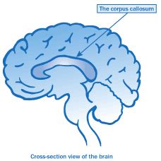 Disorders of the Corpus Callosum - National Organization of Disorders ...