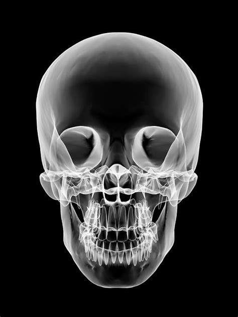 Human Skull, X-ray Artwork by Pasieka | Human skull, Skull, Xray art