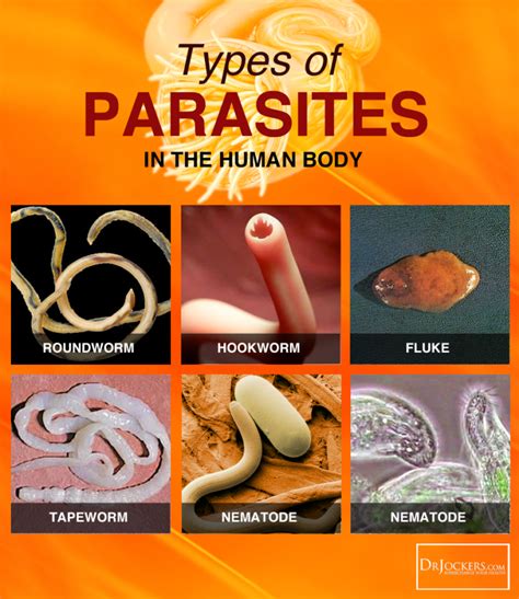 12 Herbs That Kill Parasites Naturally | Parasite cleanse diet, Parasites symptoms, Parasite cleanse