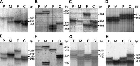 A Narrow Segment of Maternal Uniparental Disomy of Chromosome 7q31-qter in Silver-Russell ...