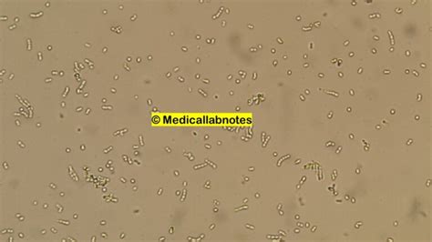 Streptococcus oralis:Introduction, Morphology, Pathogenicity