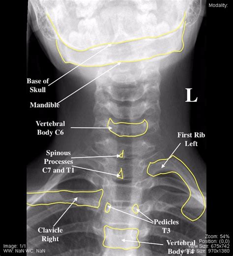 Pediatric – Undergraduate Diagnostic Imaging Fundamentals