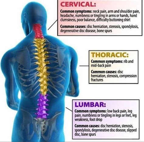 Pin on joint pain repair