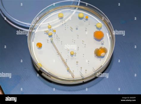 petri dish bacteria growth experiment Stock Photo - Alamy