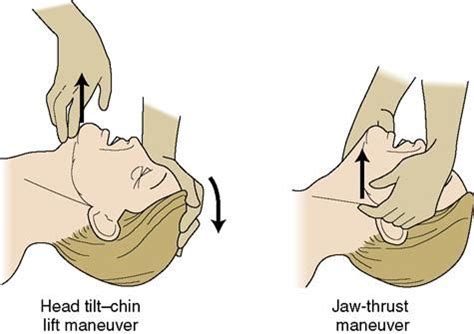 jaw thrust maneuver - - Yahoo Image Search Results | Grief counseling, Free printable coloring ...