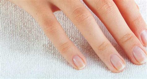 White Spots on the Nails: Causes and More