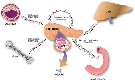 [PDF] Are stem cells a cure for diabetes? | Semantic Scholar