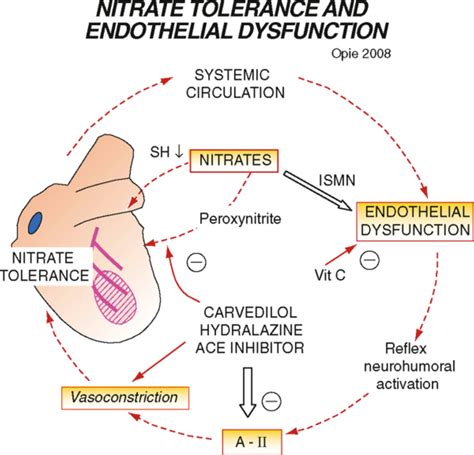 Figure 2-6 from /Nitrates and Newer Antianginals/The Nature of Angina ...