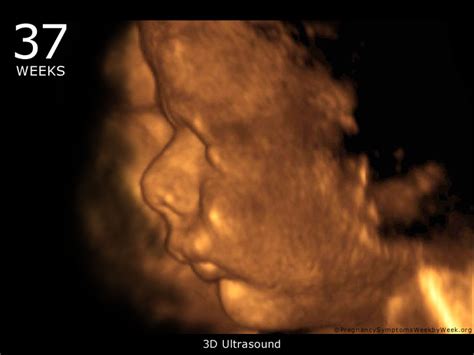 37 Week 3D Ultrasound Baby Picture | Pregnancy Symptoms Week by Week