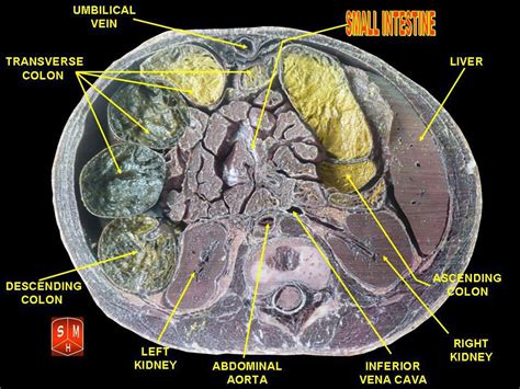 Small intestine diseases | General center | SteadyHealth.com