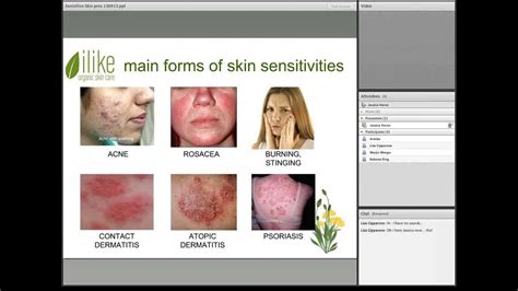 Sensitive Skin; Symptoms, Causes and Treatments - YouTube