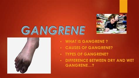 Dry gangrene,wet gangrene| difference between Dry,Wet gangrene?|Types ...