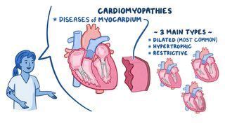 Orthopneic Position: What Is It, Uses, and How It Helps Breathing | Osmosis