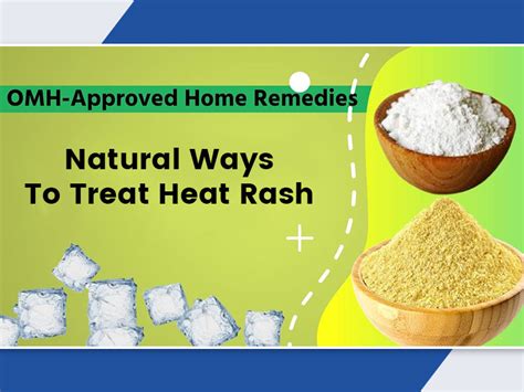 OMH-Approved Home Remedies To Treat Heat Rash or Prickly Heat