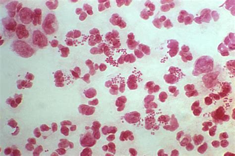 Neisseria Gram Stain