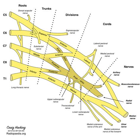 Brachial Plexus Diagram Colored