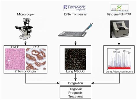 Molecular Diagnostics of Lung Cancer | Oncohema Key