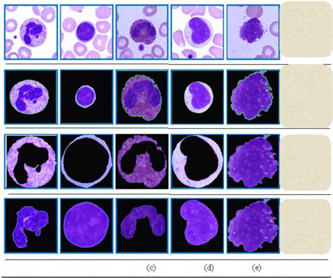 Leukocytes Histology