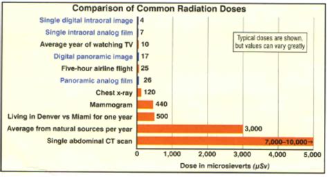 xray-radiation-dental-exposure-graph | Radiation dose, Radiation, Dental