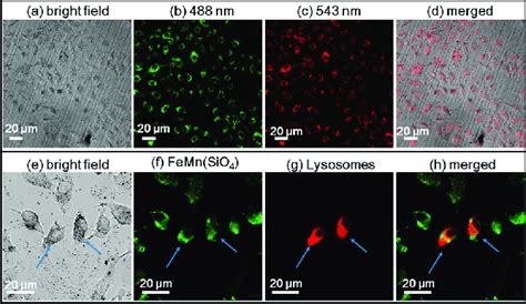 Confocal microscopy of (a) bright-field, fluorescent with excitation ...