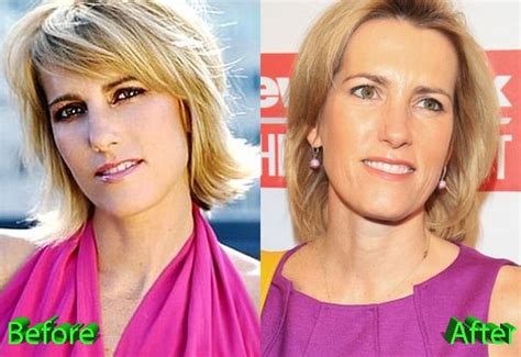 Laura Ingraham Plastic Surgery: Nothing More Than A Gossip? - Celebrity ...