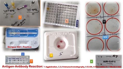 Antigen-Antibody Reaction Based Tests: Introduction, Types with Descripti