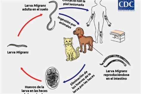 Ocular Larva Migrans.