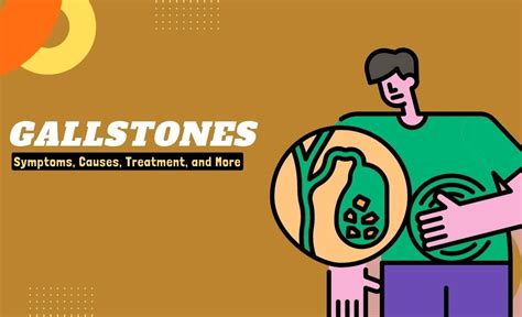 Gallstones: Symptoms, Causes, Treatment, and More - Resurchify