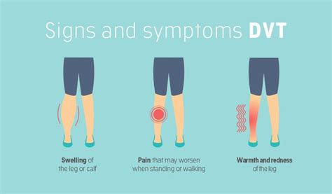 Warning signs for DVT | CancerClot™ | Deep vein thrombosis, Vein ...