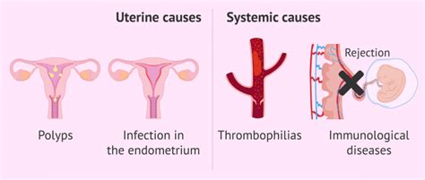 Uterine and systemic causes of implantation failure