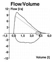 Lung Volumes - Definitions - Measuring - TeachMePhysiology